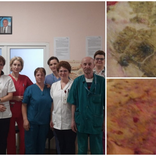 Caz medical complex tratat cu succes la Spitalul Județean de Urgență Bacău