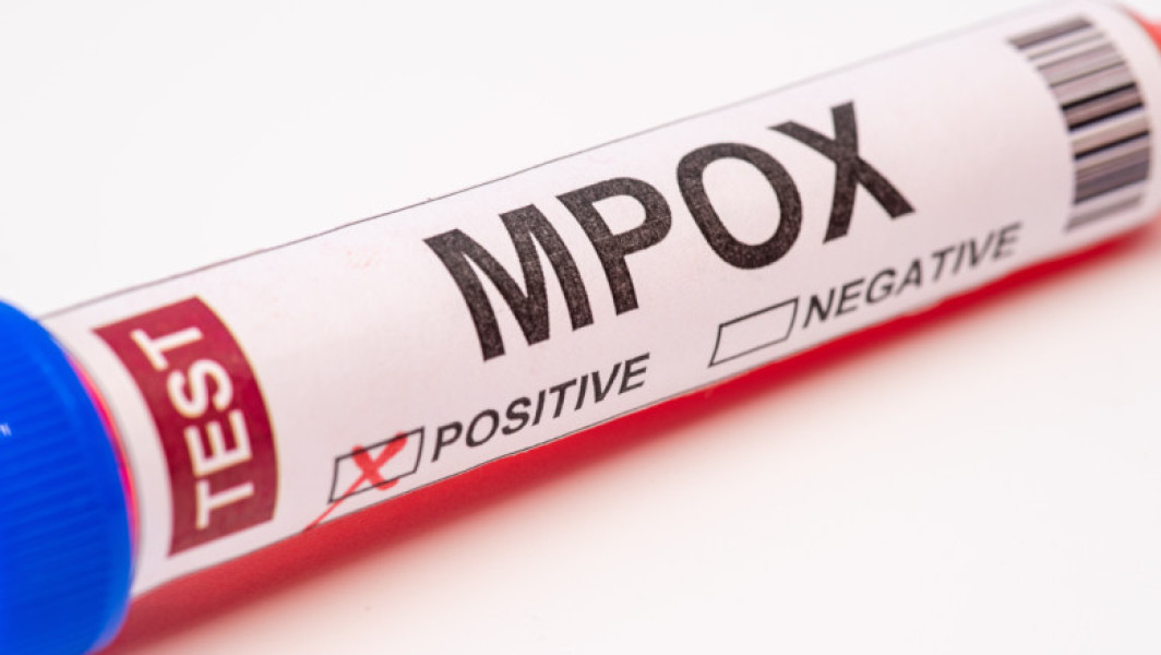 Macedonia de Nord confirmă primele cazuri de infectare cu virusul mpox