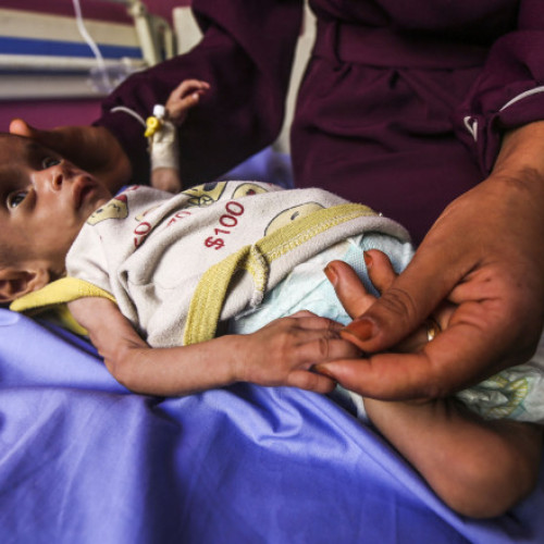 criza umanitară din Gaza: creștere alarmantă a malnutriției și restricții severe