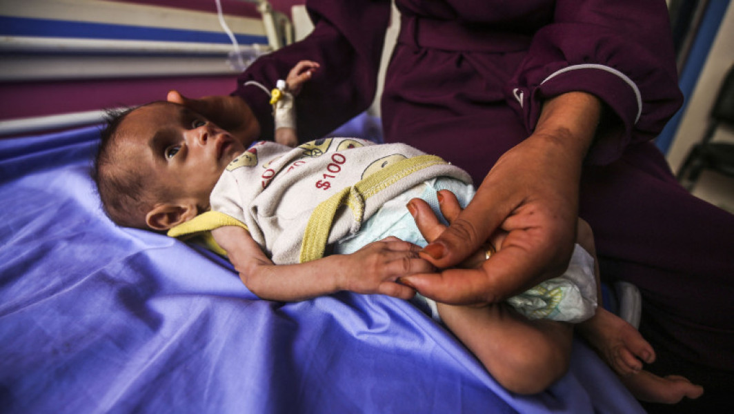 criza umanitară din Gaza: creștere alarmantă a malnutriției și restricții severe