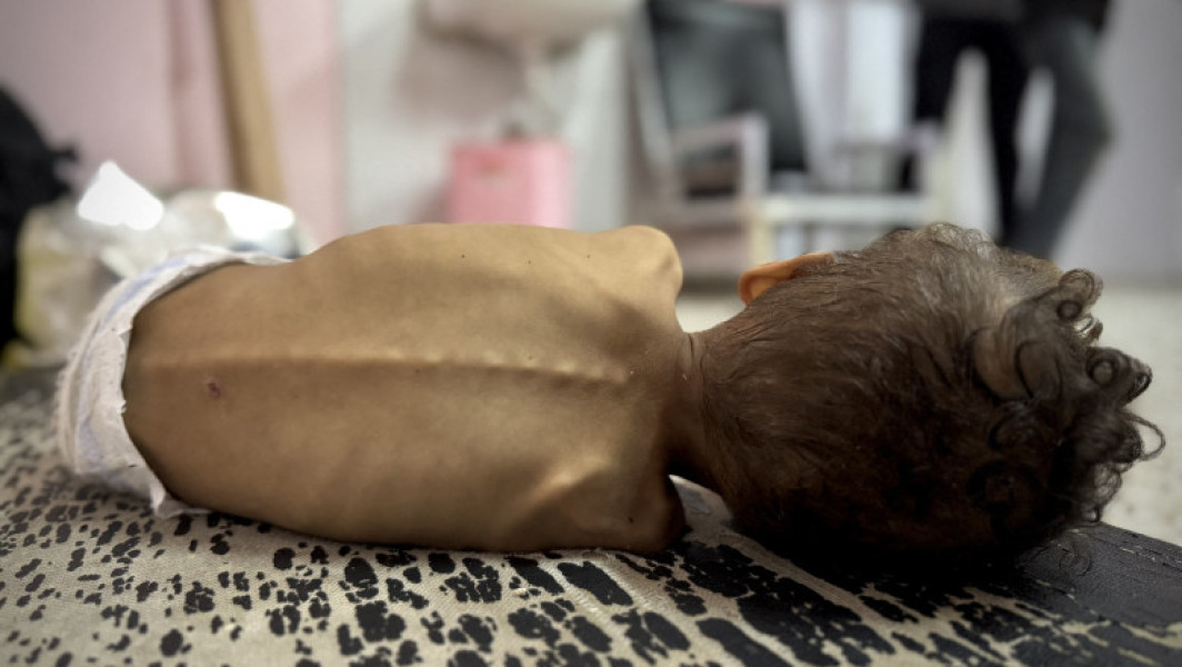 Criza umanitară severă din Gaza duce la o foamete cruntă și la suferințe din ce în ce mai mari ale populației, în special ale celor mai vulnerabili. În condițiile în care accesul la ajutoare și necesitățile de bază, precum hrana și medicamentele, este extrem de limitat, situația se înrăutățește de zi ce trece. Potrivit digi24.ro, mulți copii sub șase luni sunt hrăniți cu ierburi, semințe, ceai sau bucăți de pâine, din cauza penuriei de lapte praf. Experții avertizează că această practică poate provoca probleme stomacale și riscul de sufocare, fiind foarte periculoasă pentru sănătatea copiilor mici.